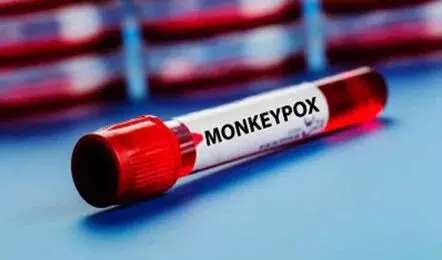 Monkeypox suspect absconds in Visakhapatnam