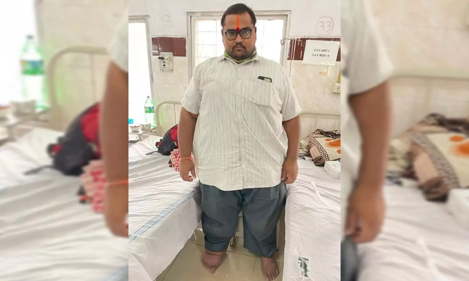Osmania hospital doctors perform rare surgery on highly obese patient