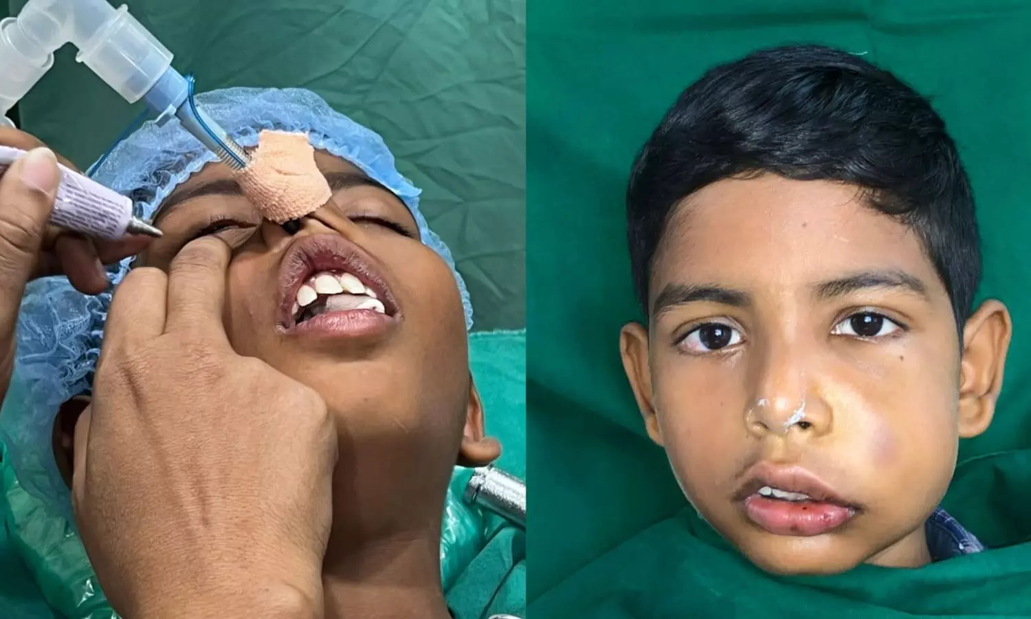 Turned away by hospitals, 11-year-old saved his eyes with support of GITAM doctors