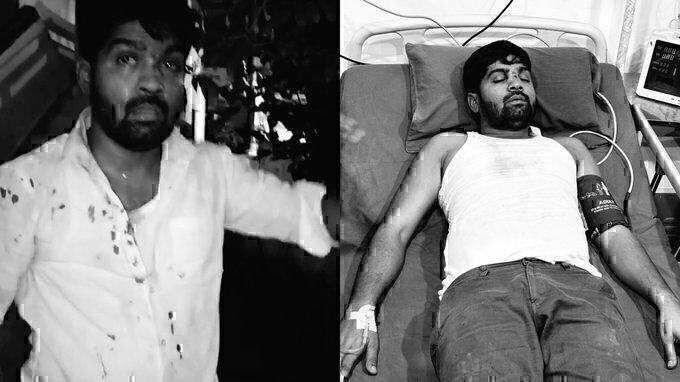Journalist critical of Telangana govt brutally attacked; women who hit his car file harassment case